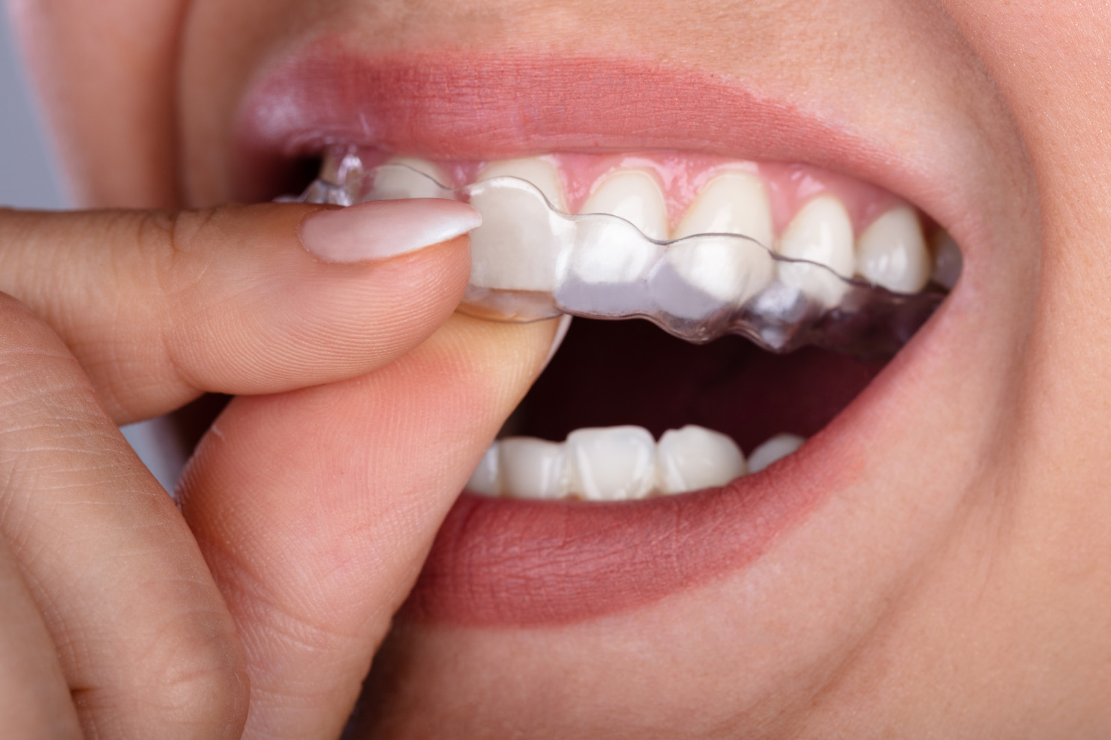 Cosmetic Dentistry